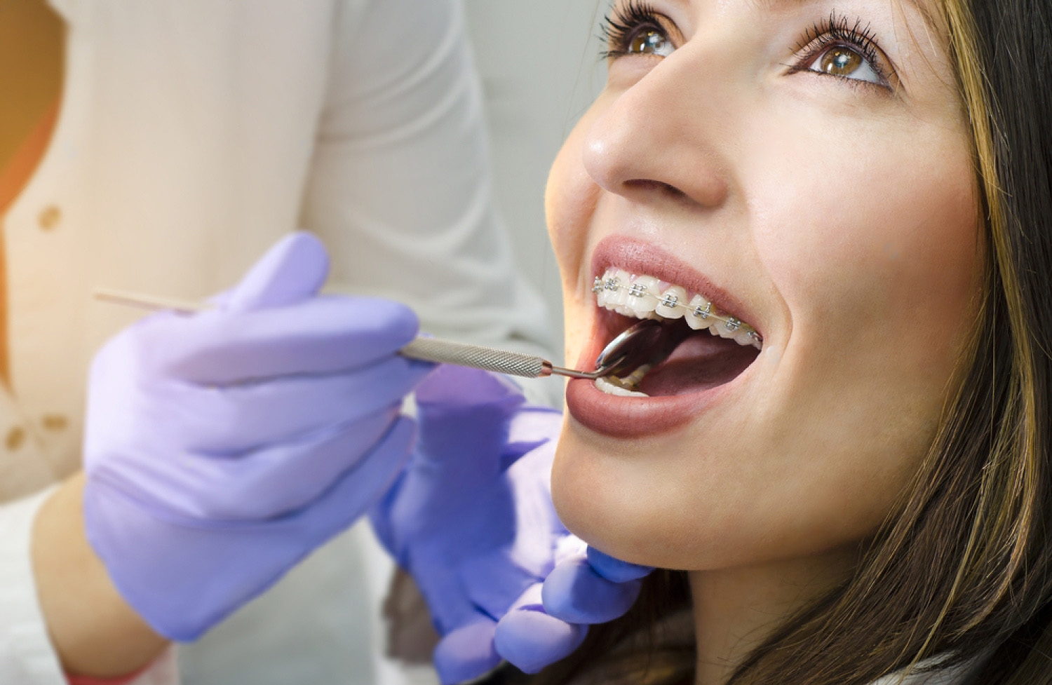 Dental Braces Northern Niagara