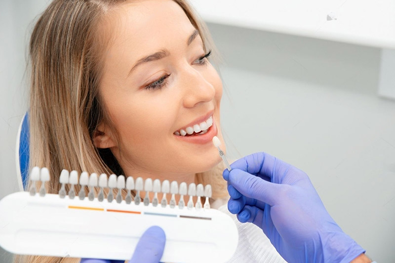 dental veneers niagara